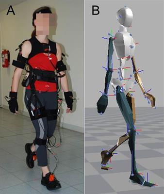 Motion Biomarkers Showing Maximum Contrast Between Healthy Subjects and Parkinson's Disease Patients Treated With Deep Brain Stimulation of the Subthalamic Nucleus. A Pilot Study